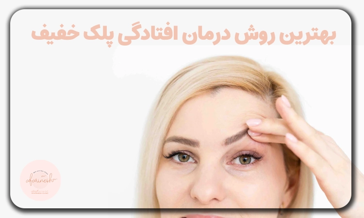 بهترین روش درمان افتادگی پلک خفیف