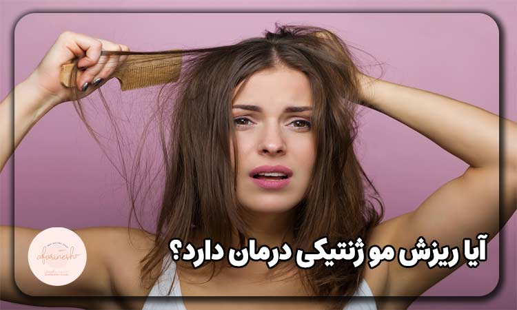 درمان ریزش مو ژنتیکی