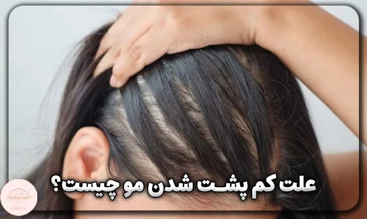 علت کم پشت شدن مو چیست؟