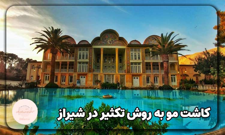 کاشت مو به روش تکثیر در شیراز