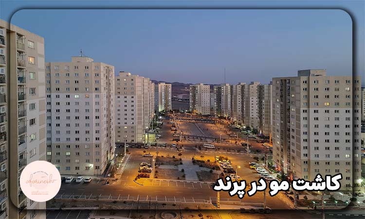 کاشت مو در پرند