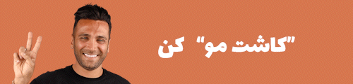 کاشت مو