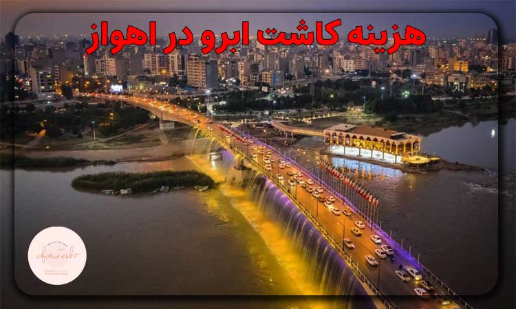 هزینه کاشت ابرو اهواز