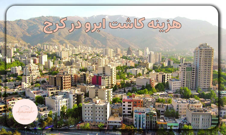 هزینه کاشت ابرو در کرج
