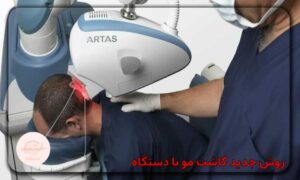 روش جدید کاشت مو با دستگاه