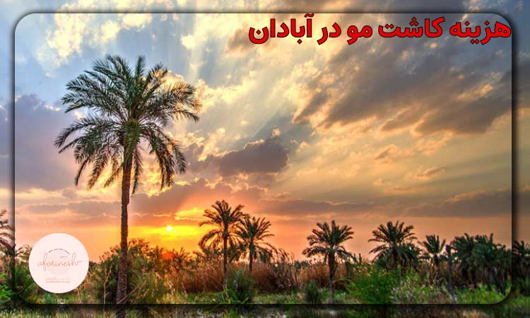 هزینه کاشت مو در آبادان