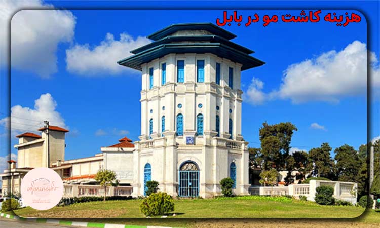 هزینه کاشت مو در بابل