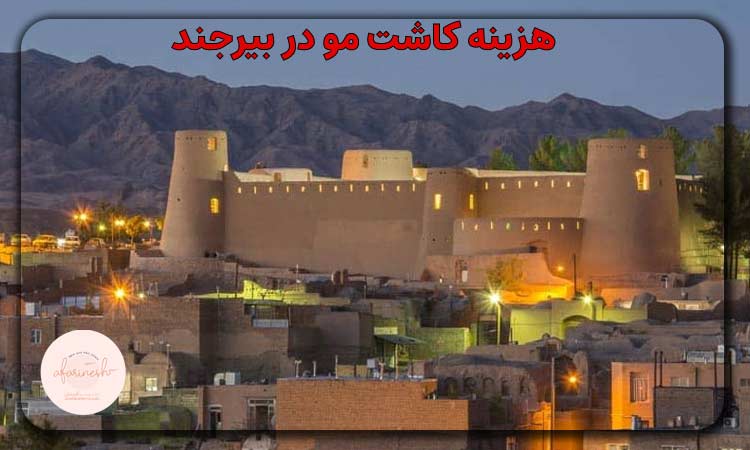 هزینه کاشت مو در بیرجند