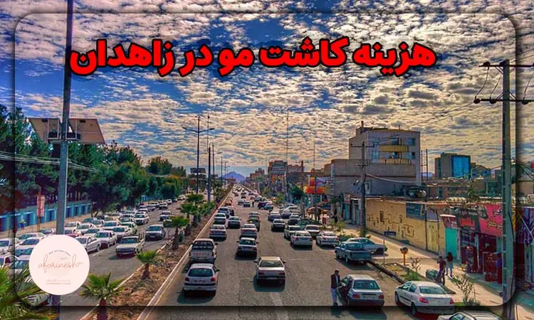 هزینه کاشت مو در زاهدان