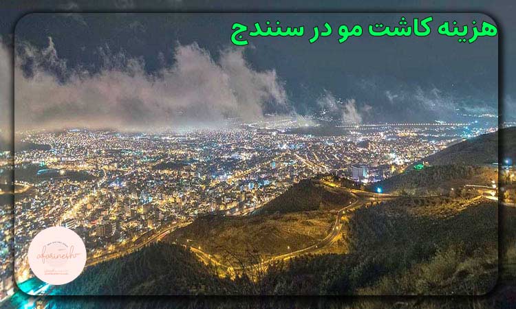 هزینه کاشت مو در سنندج