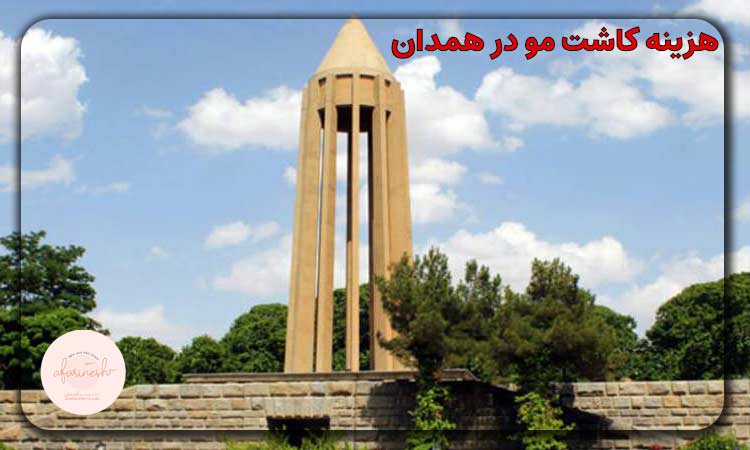 هزینه کاشت مو در همدان