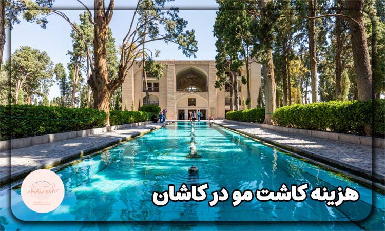 هزینه کاشت مو در کاشان