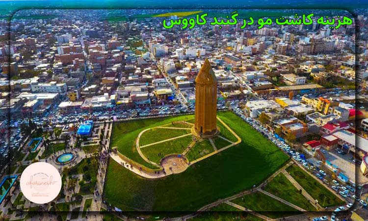 هزینه کاشت مو در گنبد کاووس
