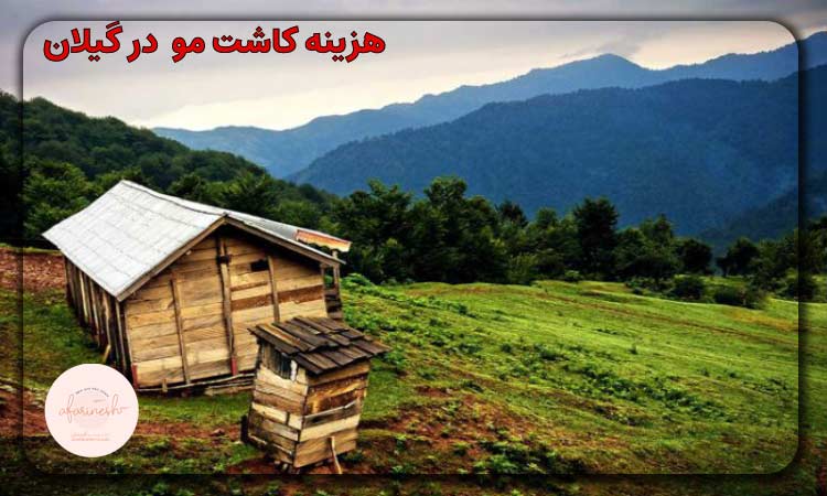 هزینه کاشت مو در گیلان
