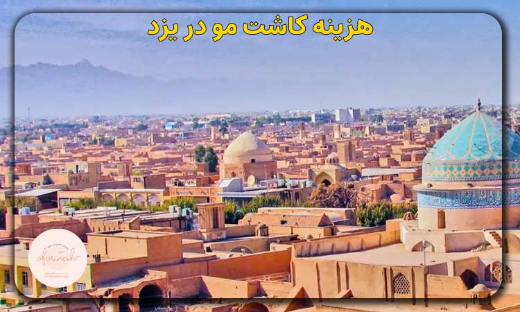 هزینه کاشت مو در یزد