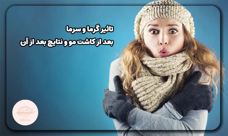 تاثیر گرما و سرما بعد از کاشت مو