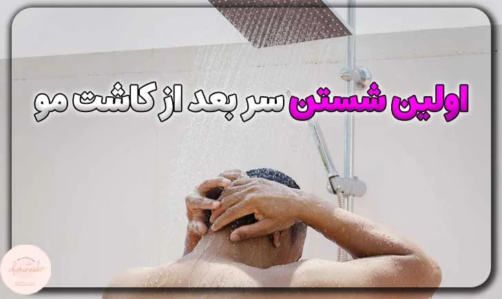 اولین شستن سر بعد از کاشت مو