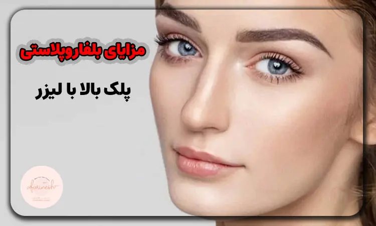 مزایای بلفاروپلاستی پلک بالا با لیزر