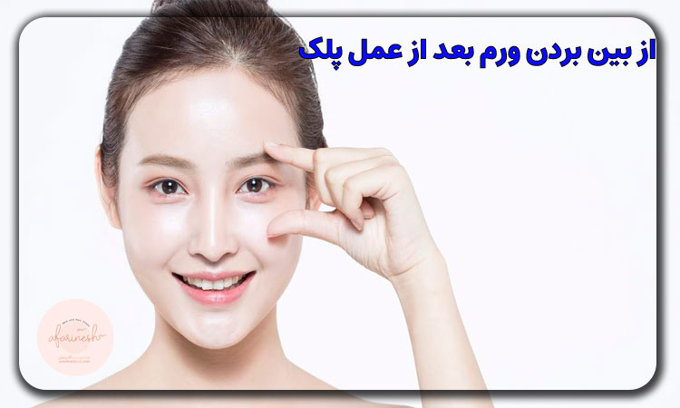 از بین بردن ورم بعد از عمل پلک