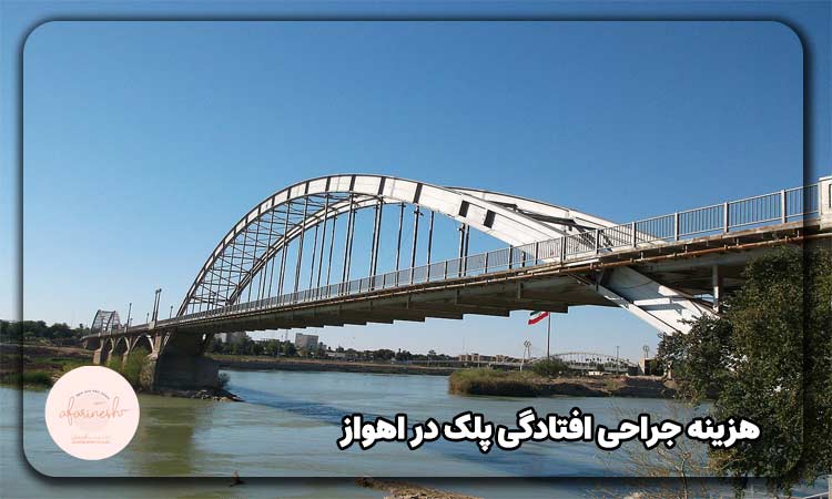هزینه جراحی افتادگی پلک در اهواز
