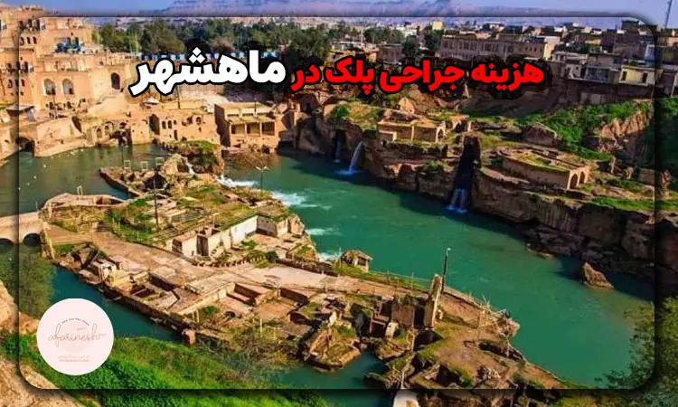 چه عواملی در هزینه جراحی پلک در ماهشهر