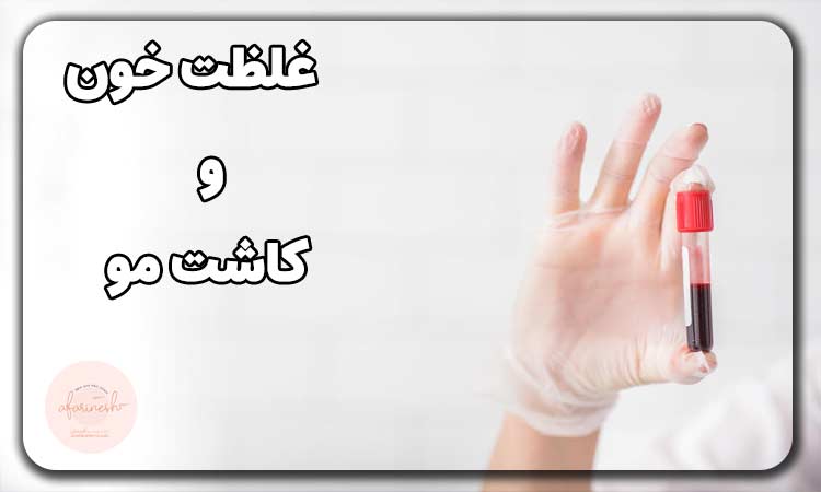 غلظت خون و کاشت مو