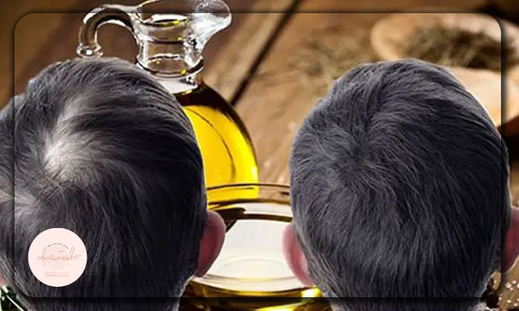خواص روغن رزماری برای موها