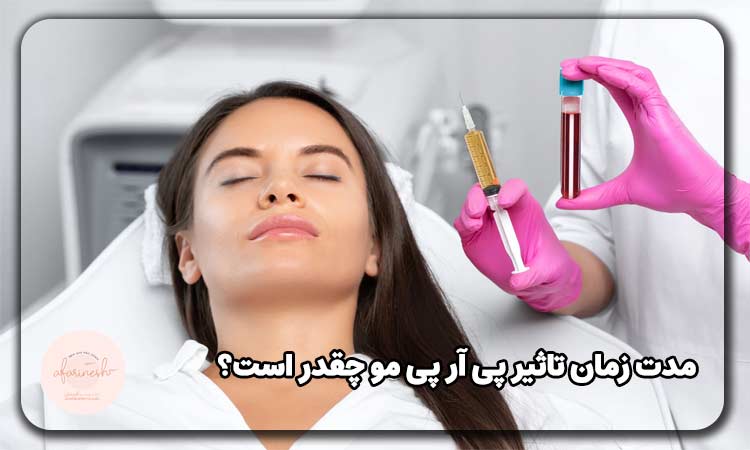 مدت زمان تاثیر پی آر پی مو چقدر است؟