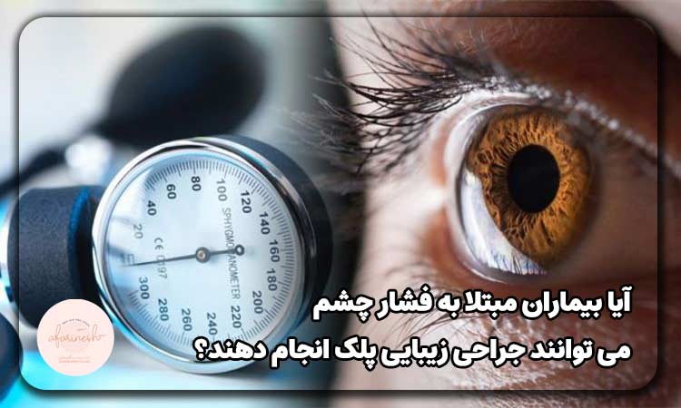 جراحی زیبایی پلک برای بیماران مبتلا به فشار چشم