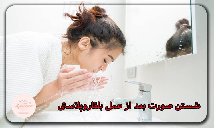 شستن صورت بعد از عمل بلفاروپلاستی