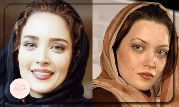 بهنوش طباطبایی قبل از عمل