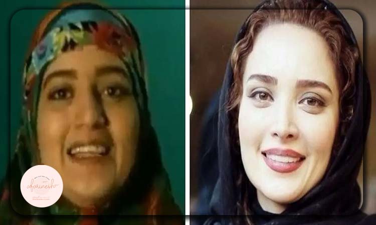 بهنوش طباطبایی قبل از عمل