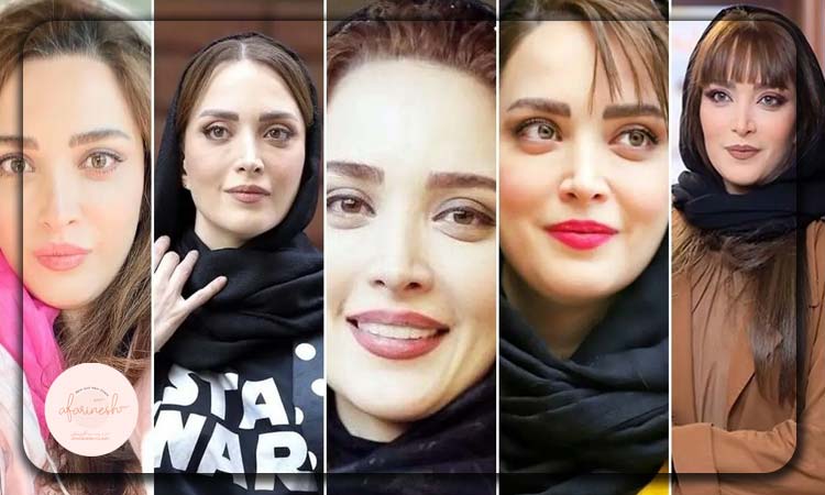 بهنوش طباطبایی قبل و بعد
