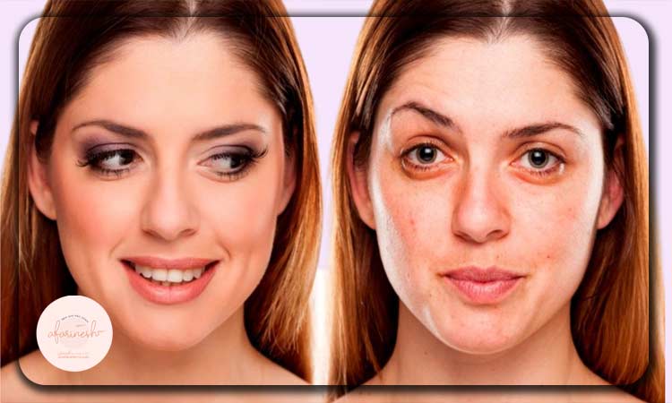 عکس فیشیال صورت قبل و بعد