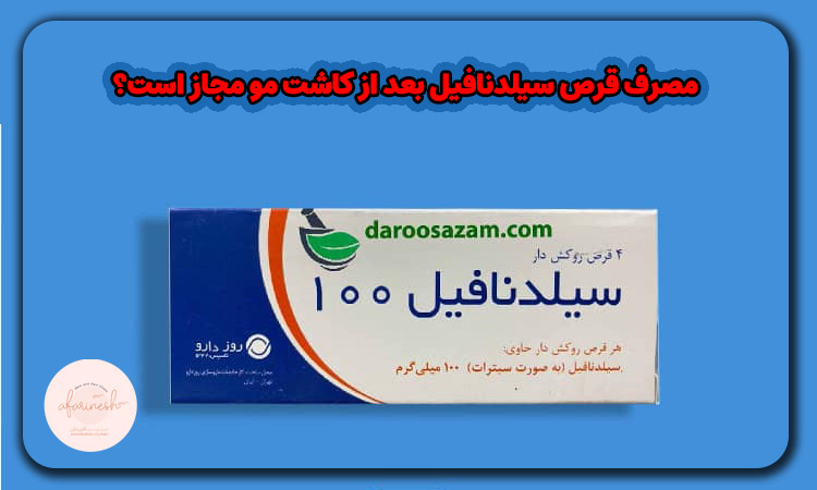 قرص سیلدنافیل بعد از کاشت مو