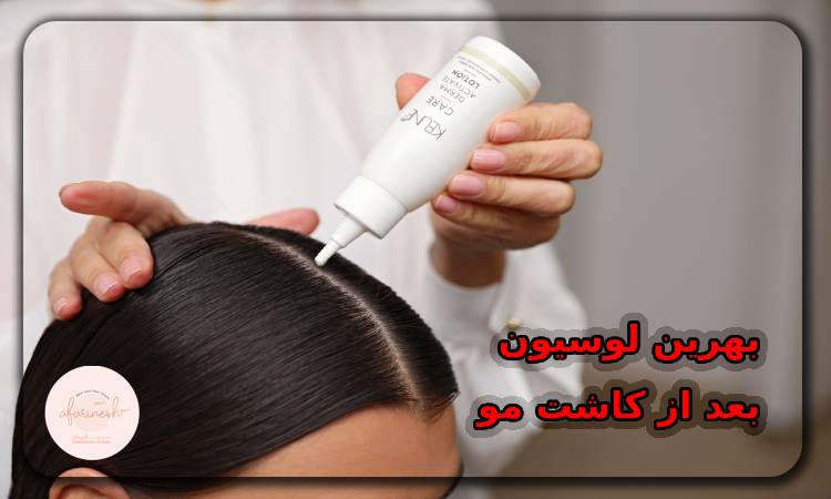 معرفی بهترین لوسیون بعد از کاشت مو