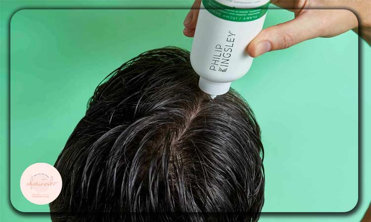 نکات مهم برای استفاده از پماد ضد خارش پوست سر