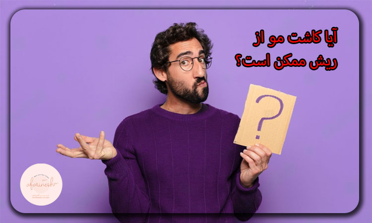 کاشت مو از ریش