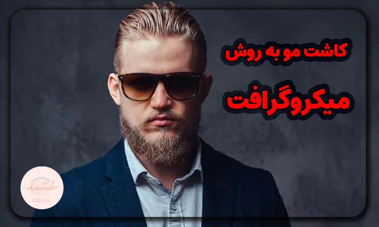 کاشت مو به روش میکروگرافت