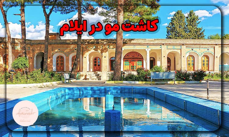 کاشت مو ایلام