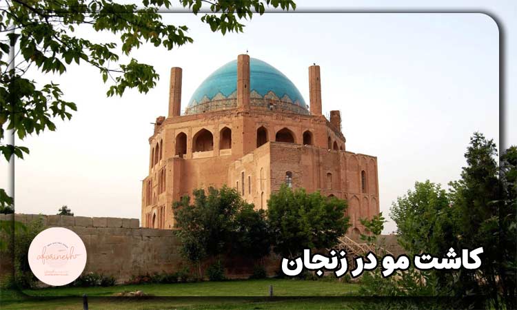 بهترین کلینیک کاشت مو در زنجان