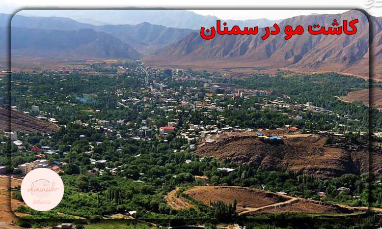 کاشت مو در سمنان