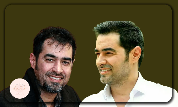 کاشت مو شهاب حسینی