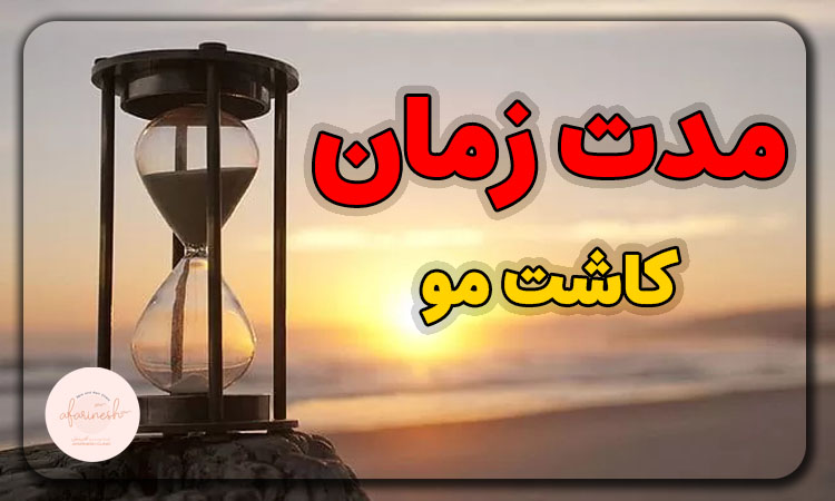 کاشت مو چند ساعت طول می کشد؟