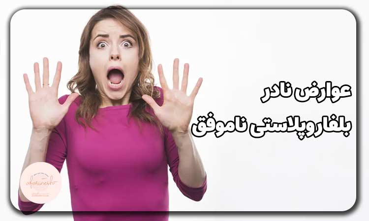 عوارض نادر بلفاروپلاستی ناموفق