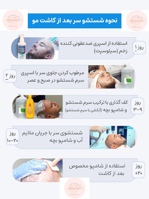 نحوه شستشو بعد از کاشت مو