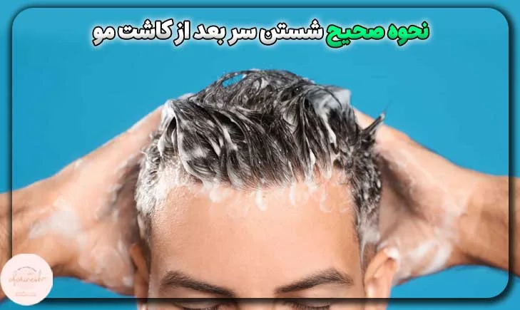 نحوه صحیح شستن سر بعد از کاشت مو