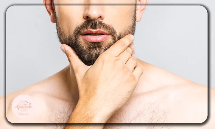 مراقبت های بعد کاشت ریش