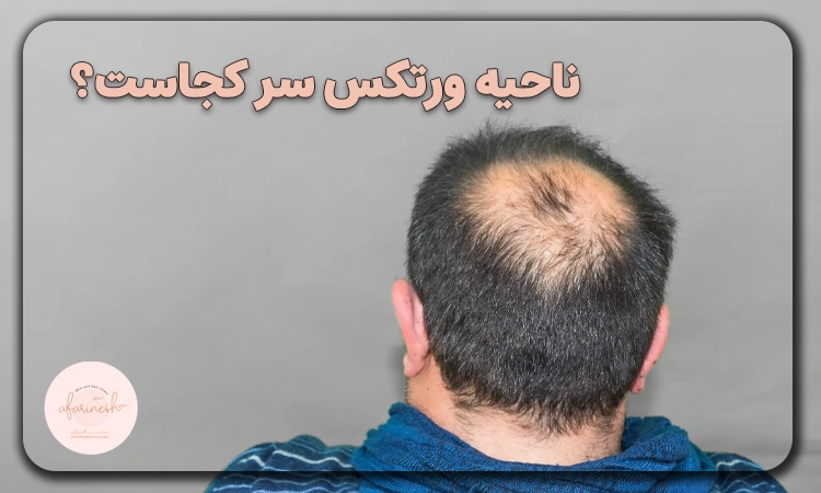 ورتکس سر کجاست؟