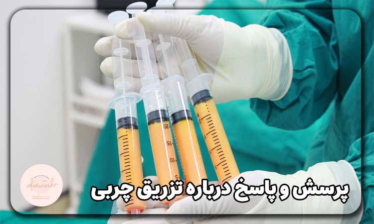 پرسش و پاسخ درباره تزریق چربی